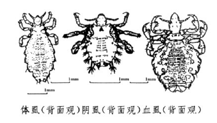 治阴虱多少钱?